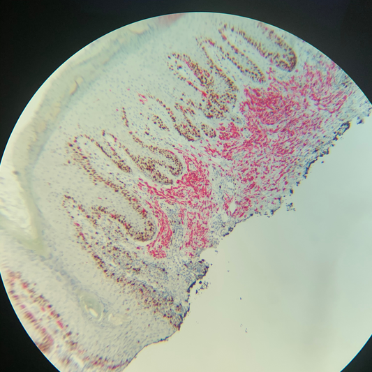 IHC Double Stain