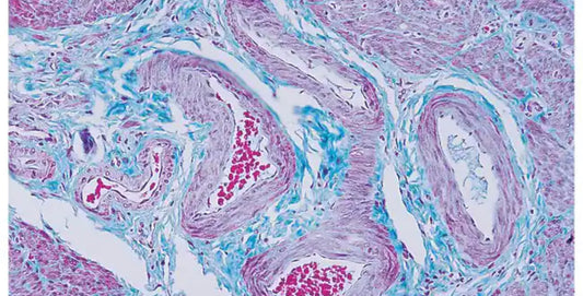 Gomori one-step trichrome