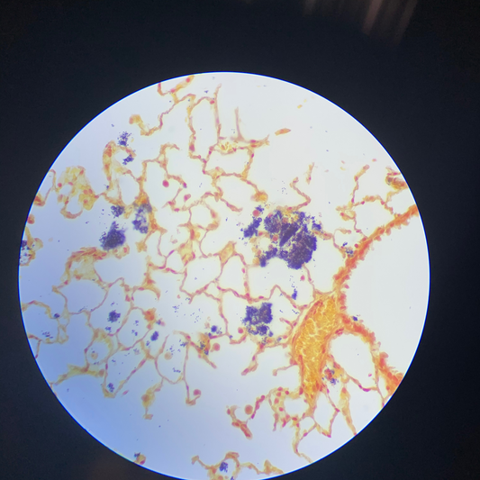 Gram Stain