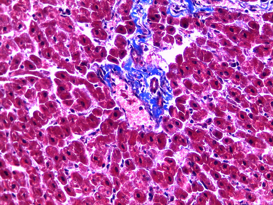 Masson's Trichrome